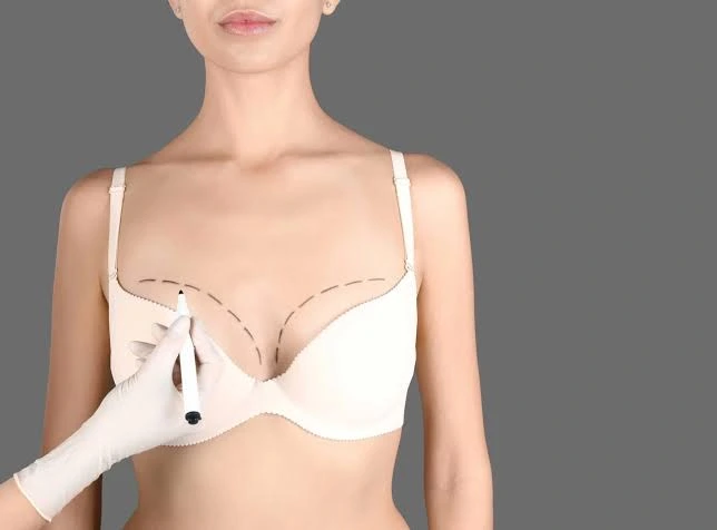 Breast Reconstruction